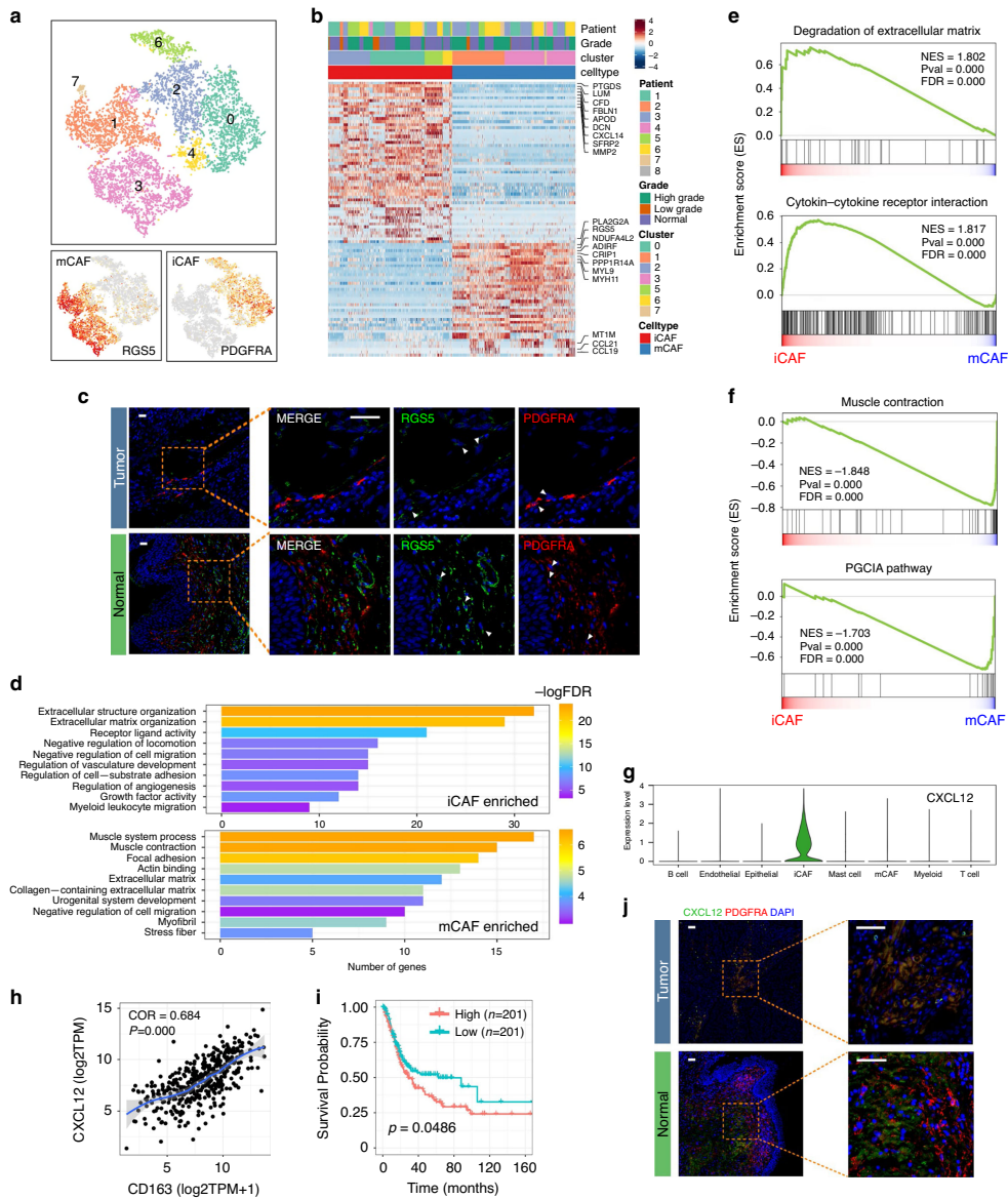 Bladder Cancer Fibroblast Subtypes
